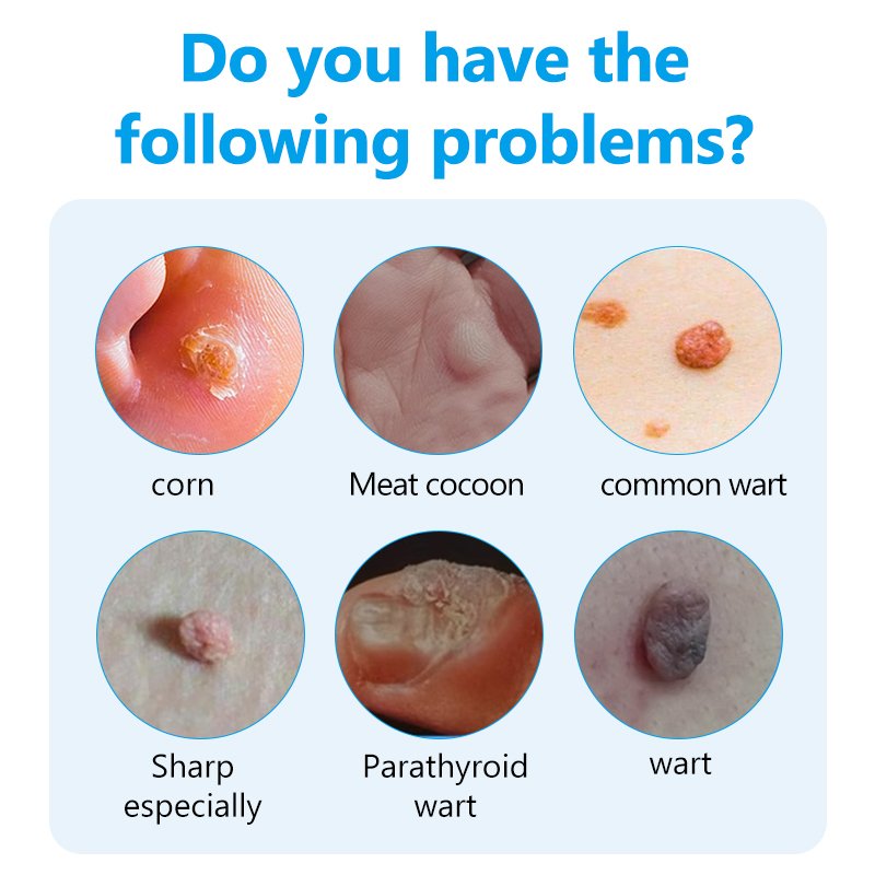 HEALMUSZ Wart Removal Patch